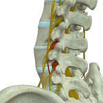 Pinched Nerve/Radiculopathy